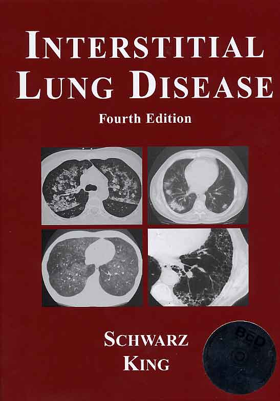 Interstitial Lung disease