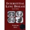 Interstitial Lung disease
