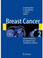 Breast Cancer-Springer