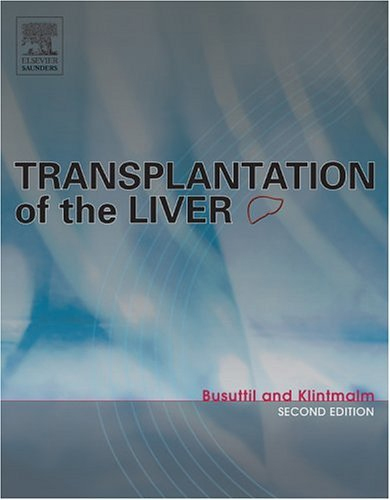 Transplantation Of The Liver , 2e