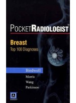 PocketRadiologist Breast - 100 Top Diagnoses Print Version