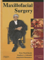 Maxillofacial Surgery: 2-Volume Set (Hardcover)