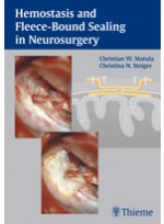 Haemostasis and Fleece-Bound Sealing in Neurosurgery