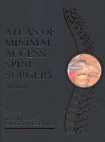 Atlas of Minimal Access Spine Surgery, 2nd edition