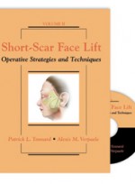 Short-Scar Face Lift: Operative Strategies and Techniques, Include DVD