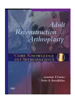 Core Knowledge in Orthopaedics: Adult Reconstruction and Arthroplasty