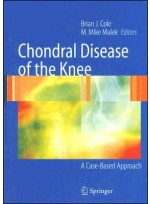 Chondral Disease of the Knee:A Case-Based Approach