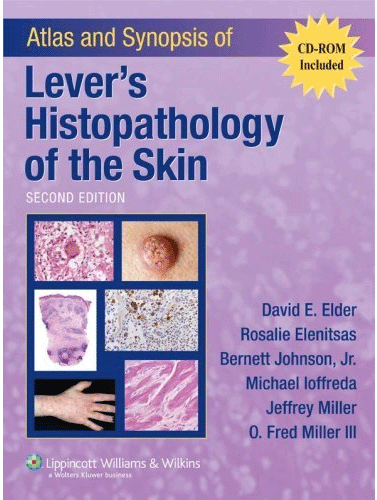 Atlas and Synopsis of Lever\'s Histopathology of the Skin, 2/e