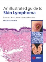An Illustrated Guide to Skin Lymphoma, 2/e