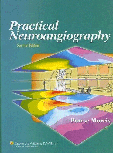 Practical Neuroangiography, 2/e
