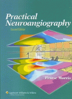 Practical Neuroangiography, 2/e