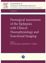 Presurgical Assessment of the Epilepsies with Clinical Neurophysiology and Functional Imaging