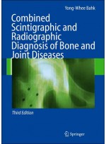 Combined Scintigraphic & Radiographic Diagnosis of Bone & Joint Diseases,3/e