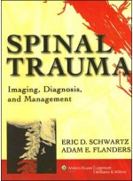 Spinal Trauma:Imaging Diagnosis & Management