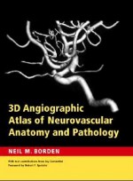 3D Angiographic Atlas of Neurovascular Anatomy & Pathology