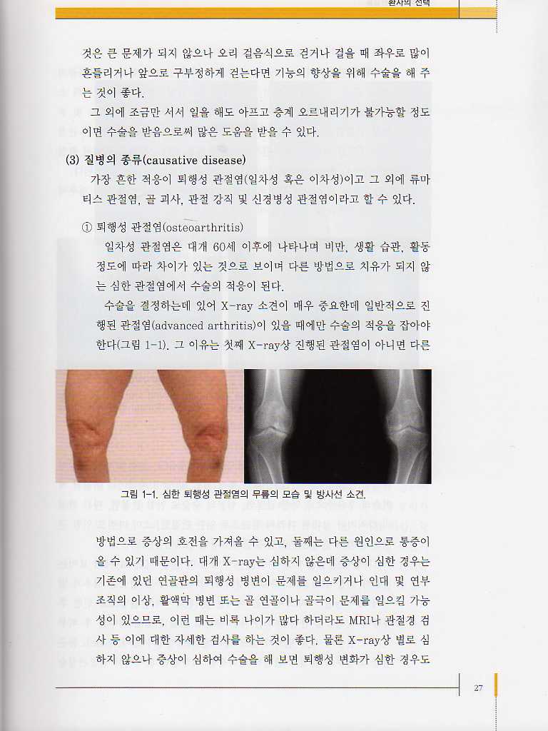 무릎의 인공관절술(2판)