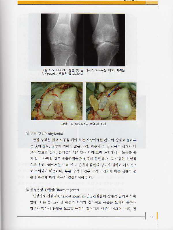 무릎의 인공관절술(2판)