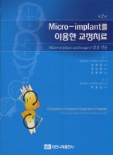 Micro-implant를 이용한 교정치료 (제2판)