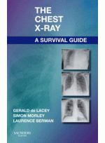 The Chest X-Ray : A Survival Guide