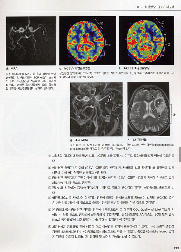 임상 MRI의 실제와 응용