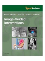 Image-Guided Intervention(2Vols)
