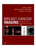 Breast Cancer Imaging: A Multidisciplinary Multimodality Approach
