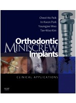 Orthodontic Miniscrew Implants - Clinical Applications