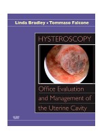Hysteroscopy: Office Evaluation and Management of the Uterine Cavity - Text with DVD-ROM