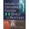 Imaging of Orthopaedic Fixation Devices & Prostheses