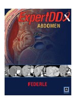 Expert Differential Diagnoses: Abdomen