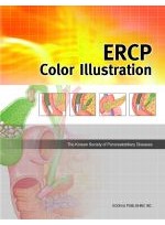 ERCP Color Illustration