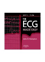 The Ecg Made Easy,7/e