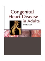 Congenital Heart Disease in Adults,3/e