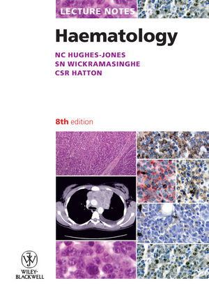 Lecture Notes: Haematology, 8th Edition