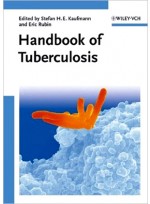Handbook of Tuberculosis(3vols)