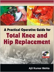 A Practical Operative Guide for Total Knee and Hip Replace