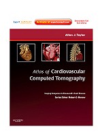 Atlas of Cardiovascular Computed Tomography: Imaging Companion to Braunwald's Heart Disease