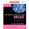 Early Diagnosis and Treatment of Cancer Series: Breast Cancer