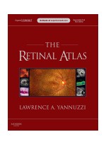 The Retinal Atlas - Expert Consult - Online and Print