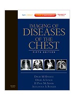 Imaging of Diseases of the Chest 5th