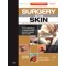 Surgery of the Skin,2/e: Online and Print with DVD