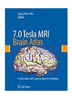 7.0 Tesla MRI Brain Atlas: In Vivo Atlas with Cryomacrotome Correlation