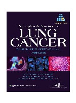 Lung Cancer :The Official Reference Text of the International Association for the Study of Lung Cancer (IASLC)(개정4판)
