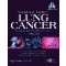 Lung Cancer :The Official Reference Text of the International Association for the Study of Lung Cancer (IASLC)(개정4판)