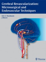 Cerebral Revascularization : Microsurgical and Endovascular Techniques