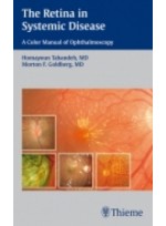 The Retina in Systemic Disease : A Color Manual of Ophthalmoscopy