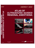 Atlas of Ultrasound-Guided Regional Anesthesia - Expert Consult - Enhanced Online and Print