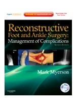 Reconstructive Foot & Ankle Surgery,2/e: Management of Complications