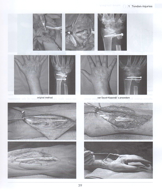 Hand Surgery (2010 IFSSH)