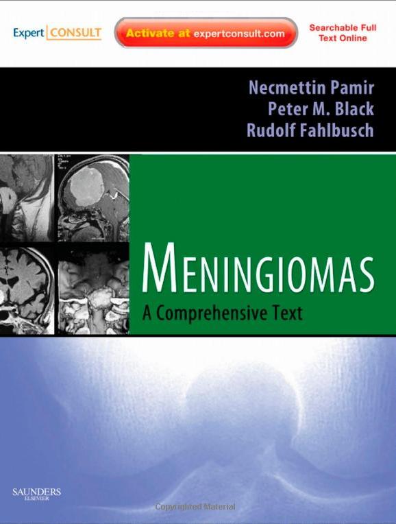 Meningiomas: Expert Consult - Online and Print